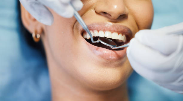 Trusted TX Emergency Dentist Experts